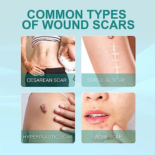 Medical Grade Scar Spray