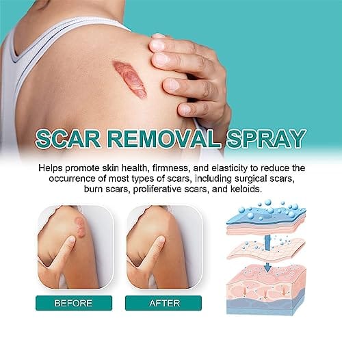Scar Spray